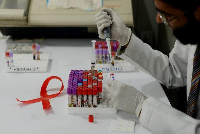 شناسایی 790 مبتلا به ایدز از ابتدای شیوع ویروس HIV در خراسان رضوی