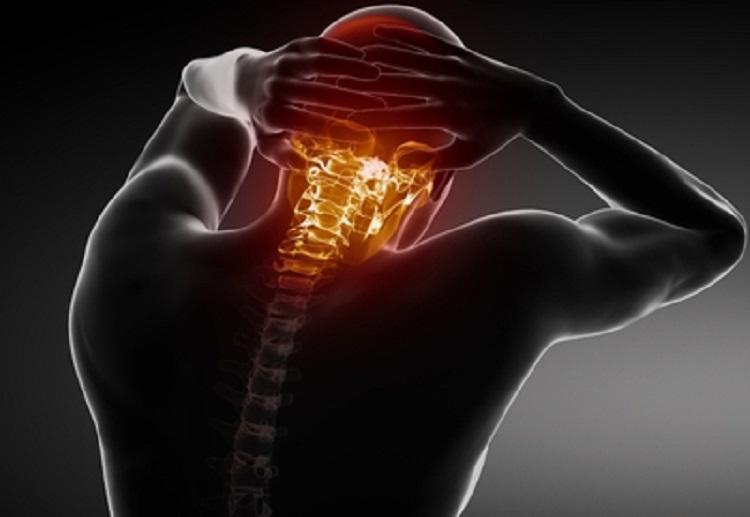 درد پشت سر نشانه چیست و چگونه درمان می گردد؟