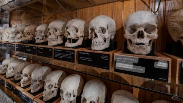 موزه های بریتانیاجمجمه های مردم زیمبابوه را تحویل داد